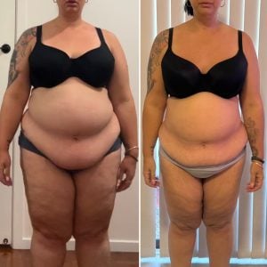 Recomp Clinic 1:1 coaching client before and after body transformation